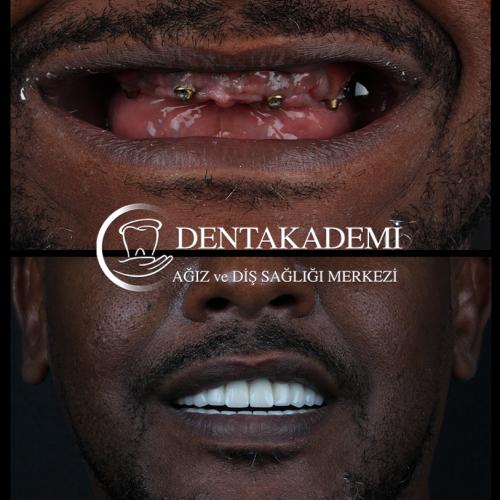 Dental care Before / After photo